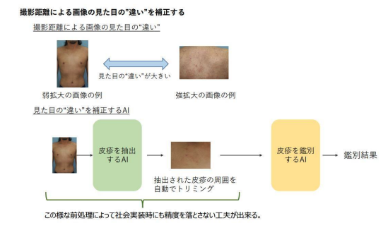 病変部抽出システム