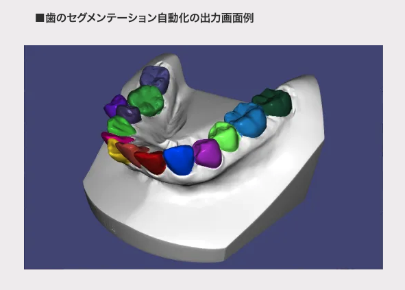 エミウム